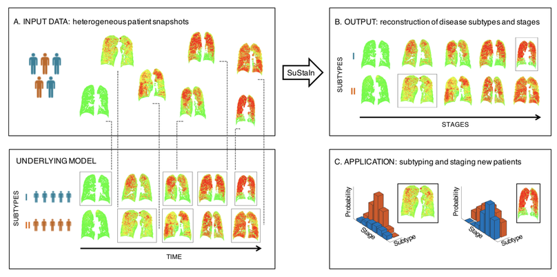Disease progression modelling in Chronic Obstructive Pulmonary Disease