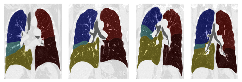 Pulmonary Lobe Segmentation with Probabilistic Segmentation of the Fissures and a Groupwise Fissure Prior